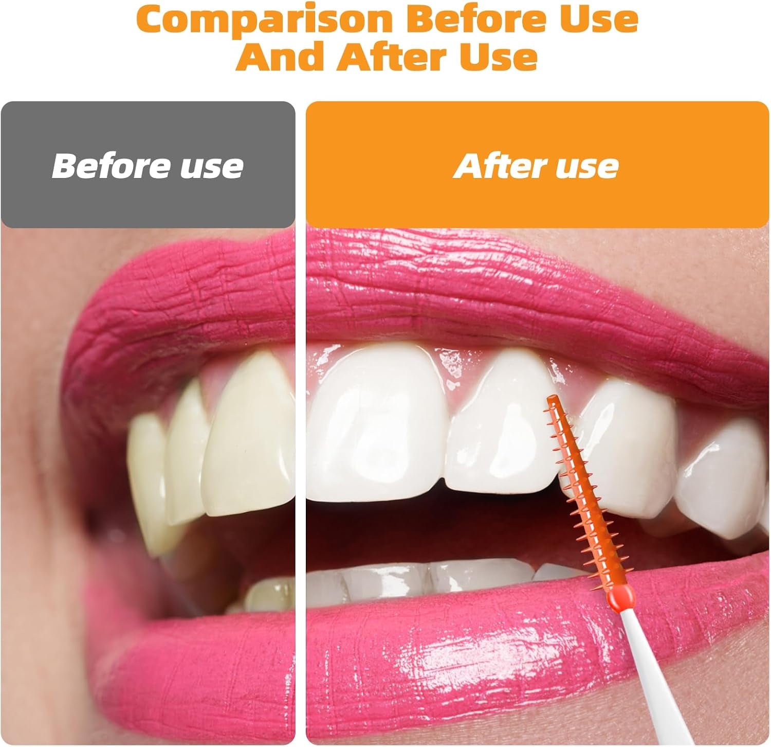 Cepillos Interdentales De Doble Uso, 200 Cepillos Interdentales Wisdom Con Estuche, Hilo Dental Para Llaves De Limpieza Oral, Herramienta De Limpieza De Palillos De Dientes (Rojo Naranja)